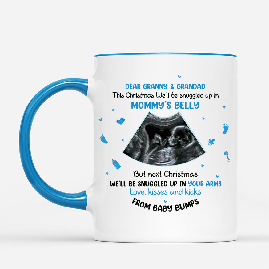 5389MUS2 custom christmas gifts for expecting parents_ ultrasound mug_ 5389M6QAA